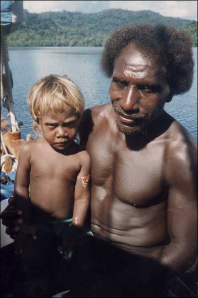 Laguna Mororo, Wyspy Salomona - Piter, naczelnik wioski Keto-Keto z wnukiem, ju po zaoeniu opatrunku